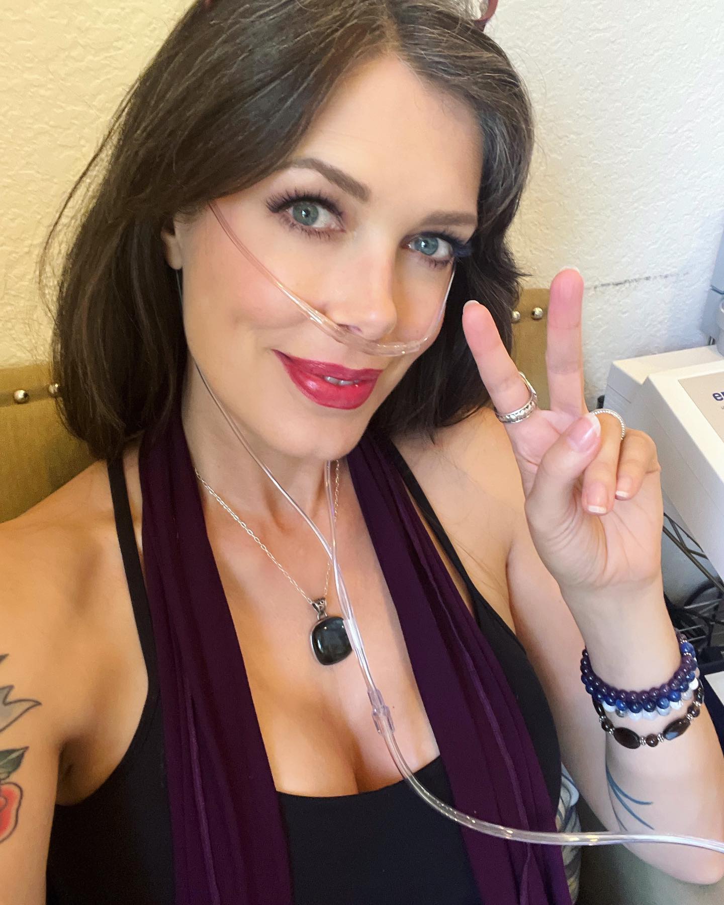 tara moss crps remission 3 months post treatment spero clinic